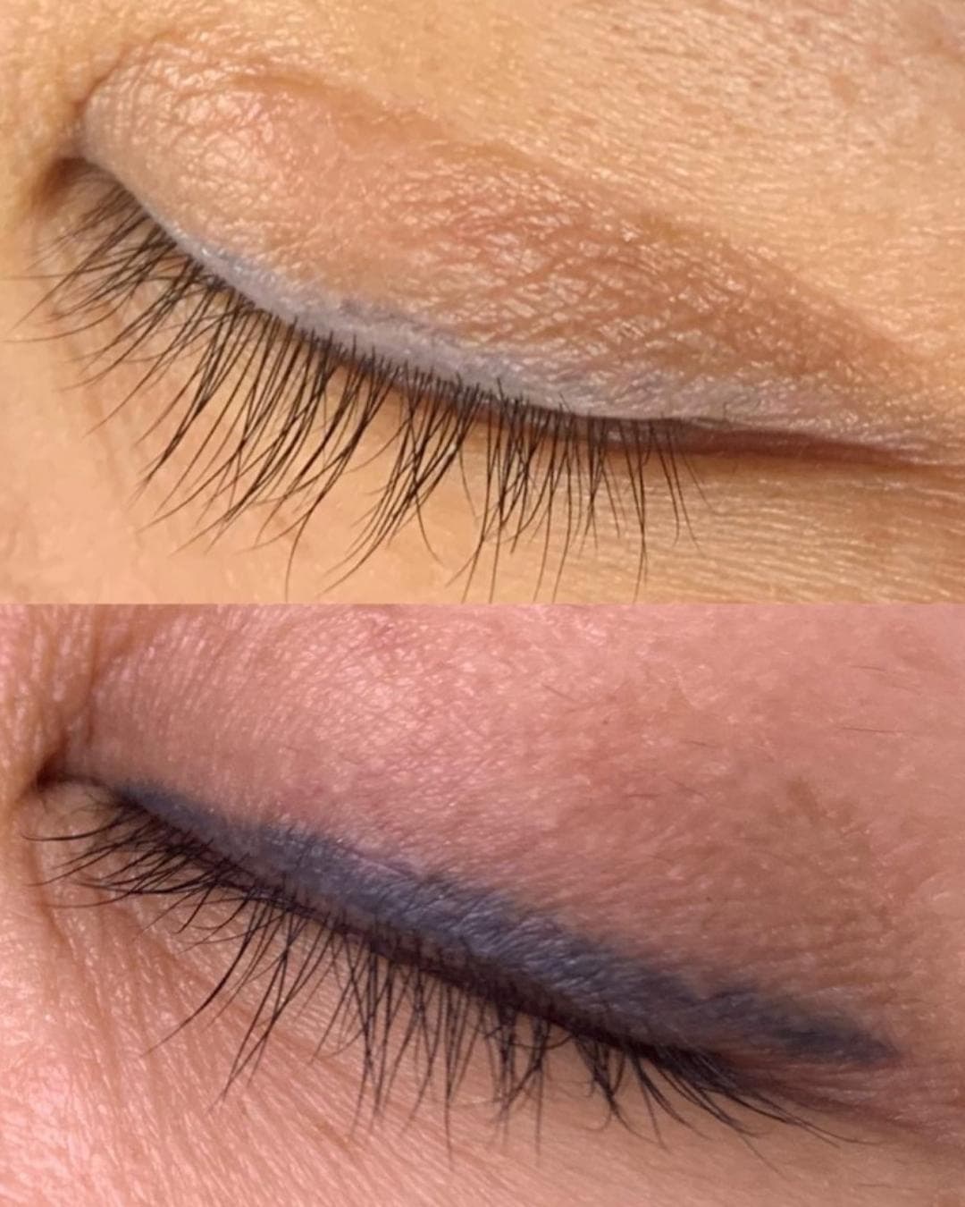 Lash behandeling voor en na